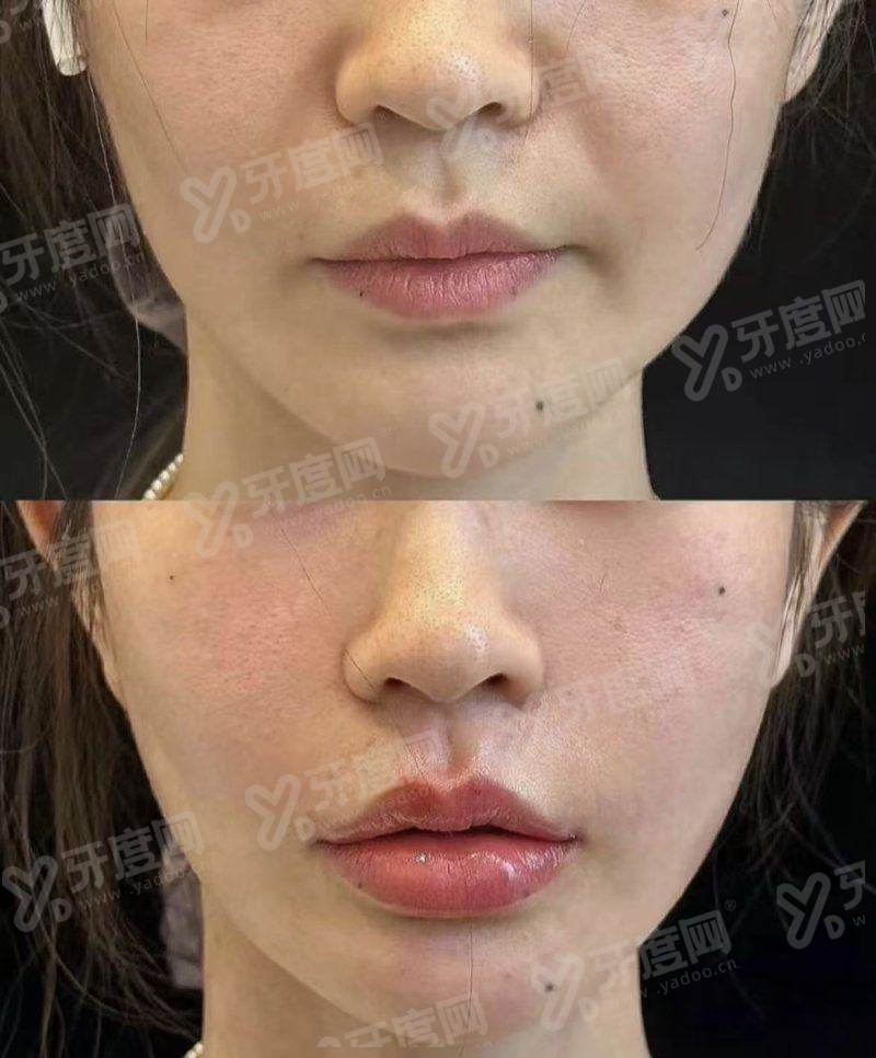 二、清潭 Dear 皮肤科医生团队与技术特色如何?(从业多年院长领衔打造高满意度诊疗方案)yanke.yadoo.cn