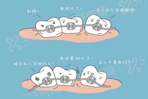 益阳伢贝健口腔种植牙集采后价格多少？单颗千元起 2026 儿童矫正新标准同步公布