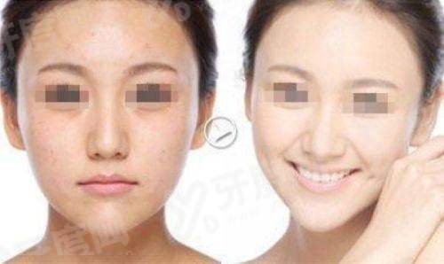 一、韩国 reberry 皮肤科中文预约指南核心解答yanke.yadoo.cn