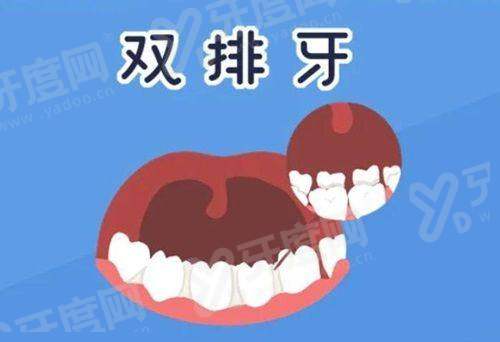 二、广州德伦口腔正规连锁值得信赖吗yanke.yadoo.cn