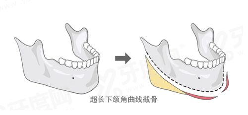 二、韩国 reberry 皮肤科医生技术与特色项目有哪些？yanke.yadoo.cn