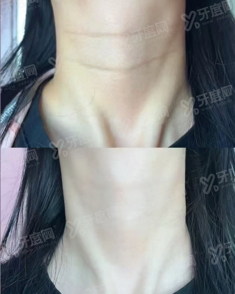 韩国Cellin皮肤科院长如何实现预约？通过首尔Eonni小程序直诊通道锁定面诊名额