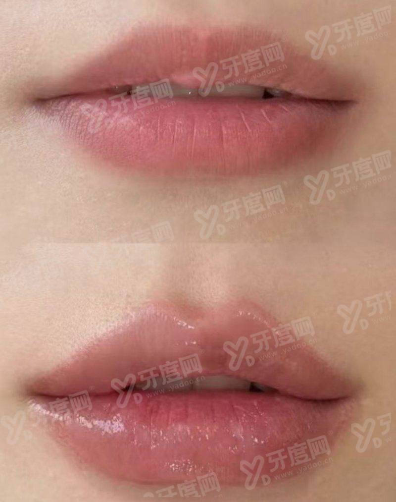 三、韩国 reberry 皮肤科价格透明吗？真实口碑如何？yanke.yadoo.cn