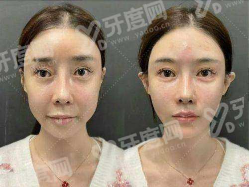 有意向到香港柔枕柔秈 (xian) GENIC SKIN MEDICAL – COLLAWHITE 医疗美容做医美项目可以通过甜伊严选预约？效果自然，一键查询轻