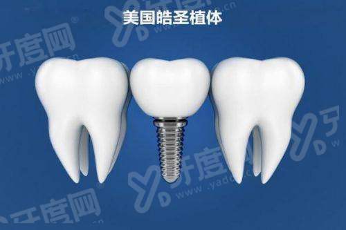 首都医科大学附属口腔医院怎么样？疑难种植技术强，公立三甲收费透明口碑赞
