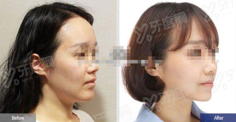 三、去韩国美乐皮肤科做皮肤管理大概需要多少预算?yanke.yadoo.cn