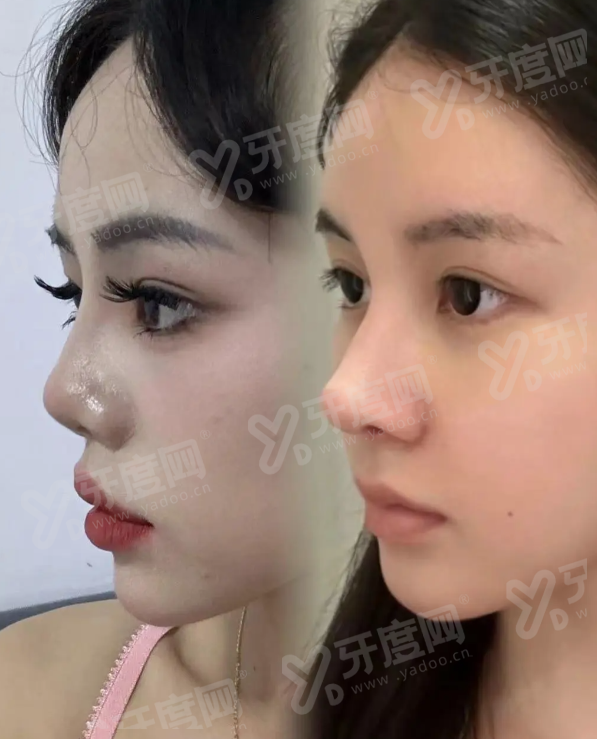 一、韩国 BTN 皮肤科院长预约怎么约?三大渠道轻松锁定面诊时间yanke.yadoo.cn