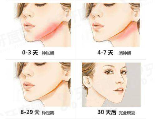 二、GoldJ皮肤科院长亲诊有何独特优势?yanke.yadoo.cn