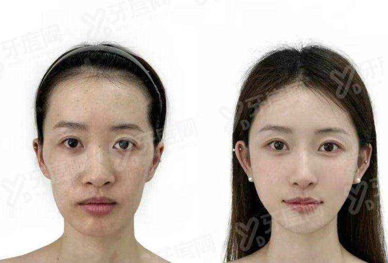 新沙theippo皮肤科预约流程？微信kr_skin+首尔Eonni小程序直连，轻松搞定新沙洞面诊行程！加首尔Eonni查新沙theippo医院官方预约