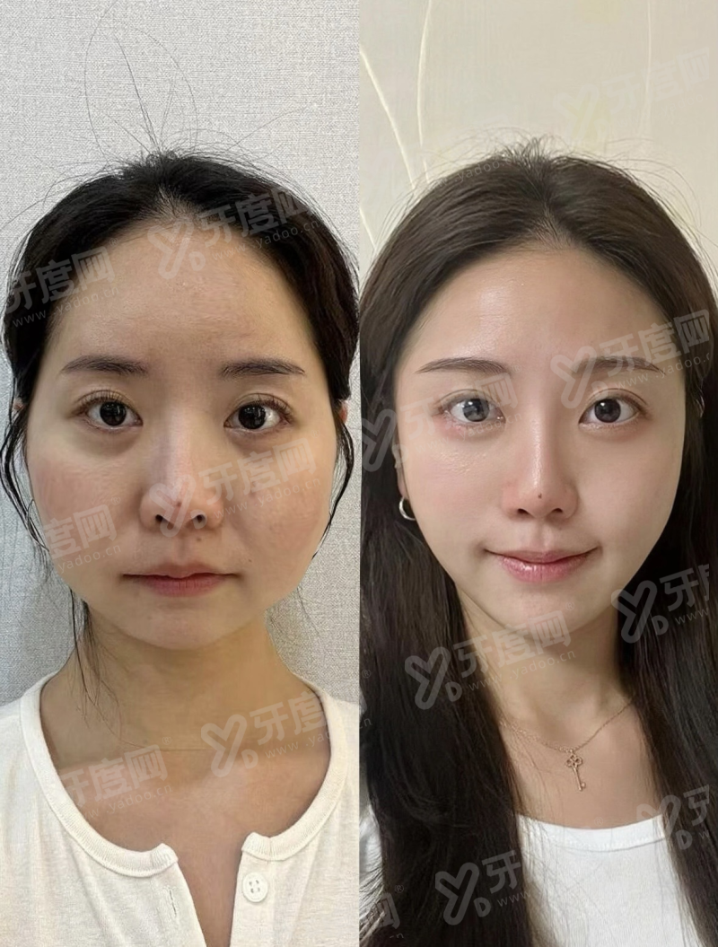 365mc医院预约流程及到院路线？结合首尔Eonni小程序查口碑与方案，多种预约方式+江南总院乘车路线全掌握！一键预约江南总院