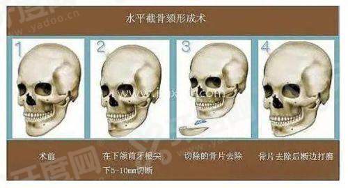 歌柔飞金泰拉抗衰中心地址及预约攻略！，首尔Eonni小程序中文直连无障碍，免排队直达！抗衰专院怎么约？