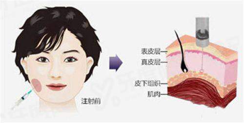 韩国瑞琦思医院怎么预约？上首尔Eonni小程序一站式搞定预约全流程，享透明公开价！直连官方通道杜绝隐形消费明明白白就医