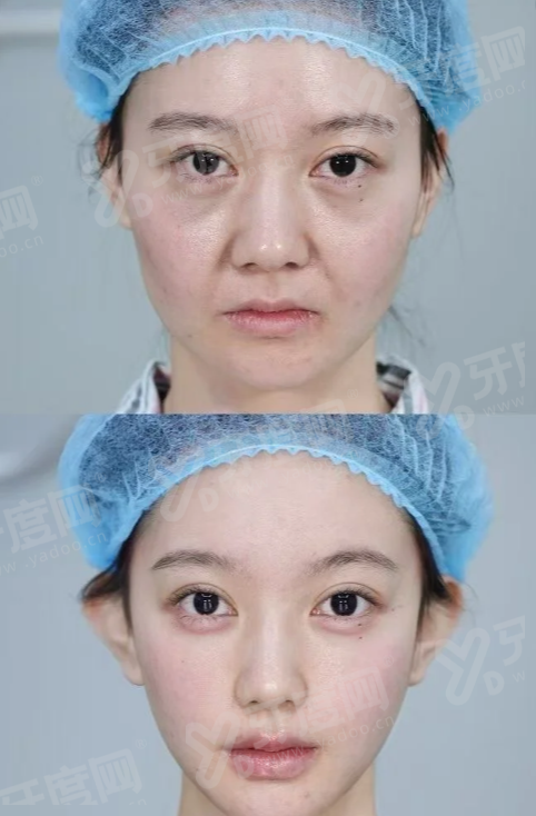 爱妮皮肤科医院怎么预约？首尔Eonni小程序一键搞定赴韩医美+生活全服务！