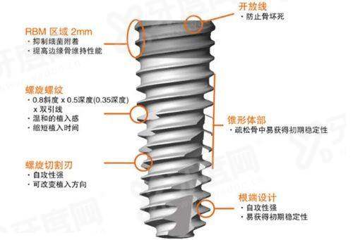 杭州美奥口腔医院种牙怎么样？微创技术稳价格透明，多品牌植体方案靠谱值得选