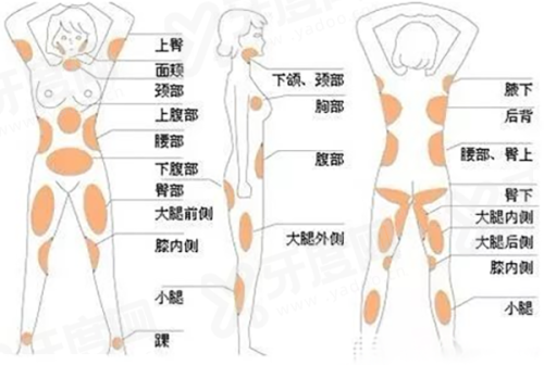 二、东大门 Doctors 皮肤科有哪些核心技术优势让患者口碑爆棚?yanke.yadoo.cn