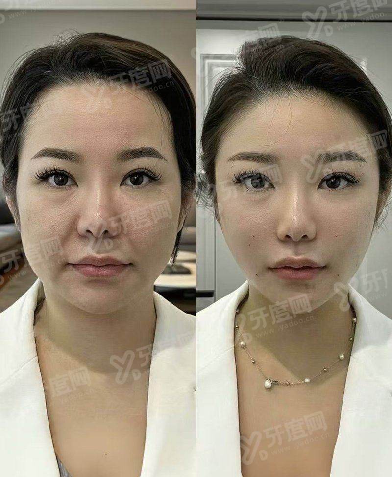 韩国美乐皮肤科中文预约指南？通过首尔Eonni小程序预约院长面诊查价格