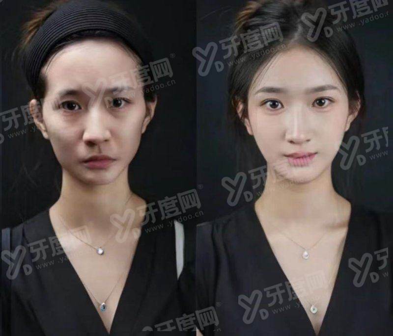 东大门 Doctors 皮肤科怎么预约？通过首尔Eonni小程序一键挂号查东大门核心名医档期