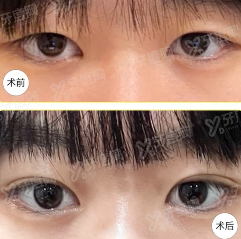 二、韩国 GU 皮肤科院长亲诊有哪些特殊技术优势?yanke.yadoo.cn