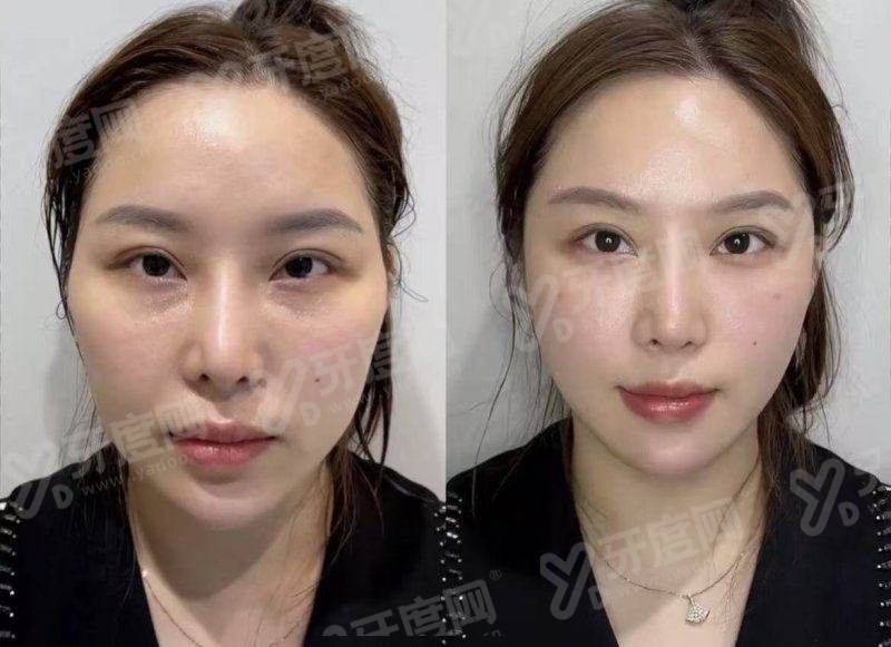 二、韩国美乐皮肤科医生技术与特色项目有哪些优势?yanke.yadoo.cn