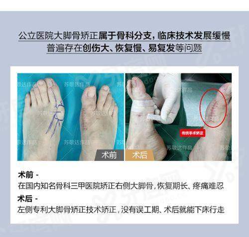 韩国blsclinic皮肤科预约攻略大全：通过首尔Eonni小程序一键预约查价格
