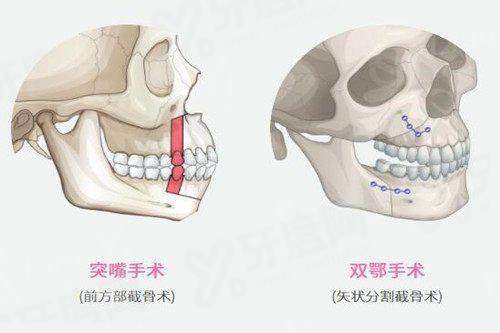二、韩国 Petit 皮肤科院长团队有哪些技术优势与擅长领域?yanke.yadoo.cn