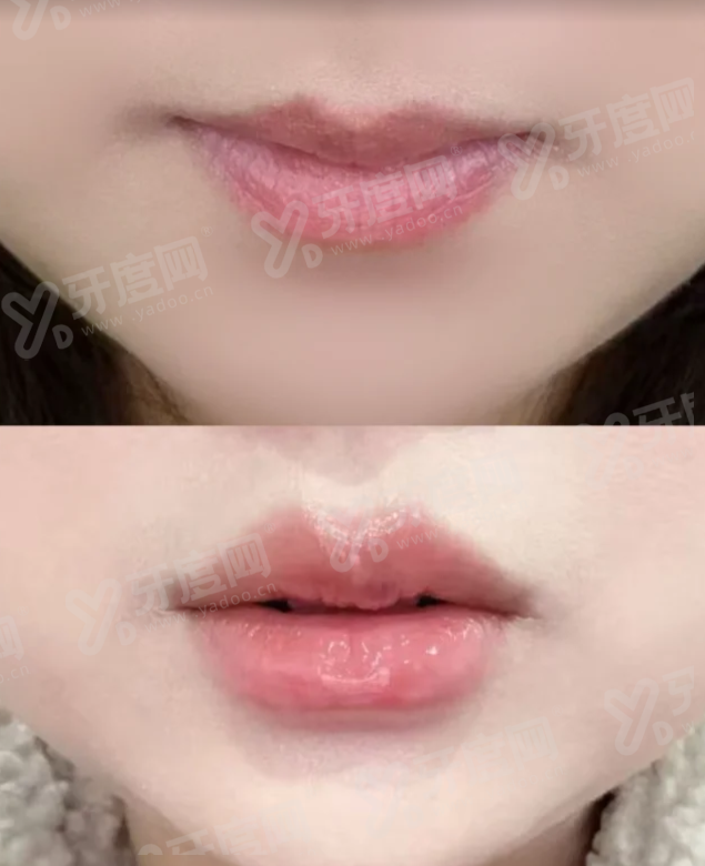 三、清潭 OK 皮肤科真实口碑与医生实力如何?yanke.yadoo.cn