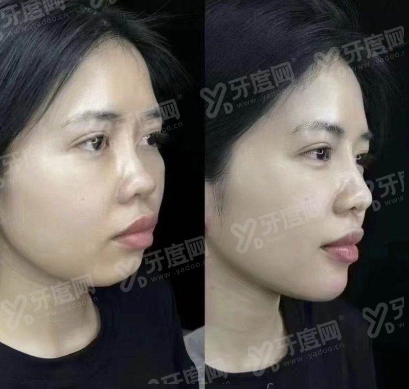 一、清潭 OK 皮肤科中文预约指南核心步骤全解析?yanke.yadoo.cn