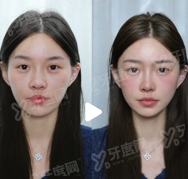 想要预约韩国 petit 皮肤科院长怎么做？通过首尔 Eonni 小程序一键查询院长档期
