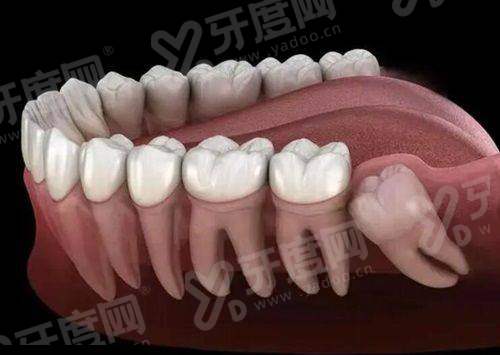 二、厦门看牙哪里能走医疗保险报销yanke.yadoo.cn