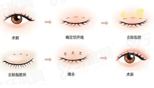 三、真实顾客如何评价江南 V 皮肤科的服务与成效?yanke.yadoo.cn