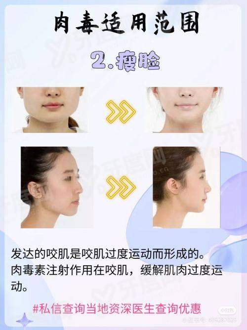 三、韩国 DICARAT 皮肤科服务项目价格参考与真实口碑如何?yanke.yadoo.cn