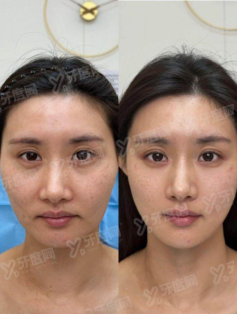 二、江南 V 皮肤科有哪些特色诊疗项目与透明价格体系?yanke.yadoo.cn