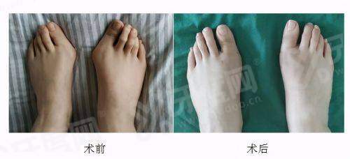 三、济州NowMedi医院价格明细与预约方式有哪些？yanke.yadoo.cn