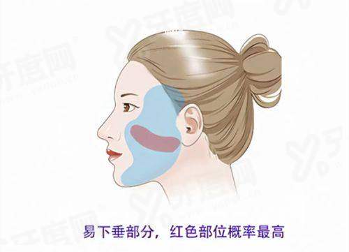 一、圣水 newlline 皮肤科面诊预约攻略的核心流程是什么?yanke.yadoo.cn