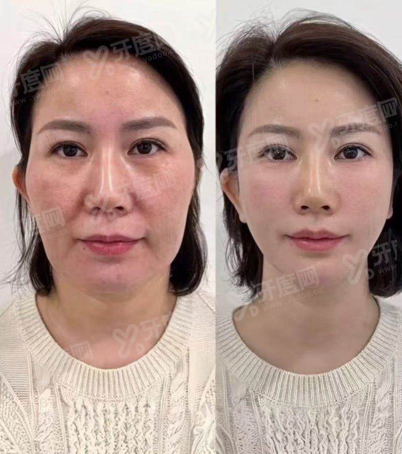 三、韩国 Cleor 皮肤科热门项目价格参考与真实口碑分享?yanke.yadoo.cn