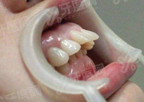 二、临沂种牙哪里好且价格实惠yanke.yadoo.cn