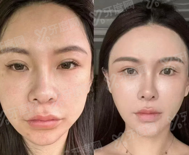 二、韩国 JD 皮肤科医生团队有何独特优势?首尔大学双院长亲诊保护成效yanke.yadoo.cn