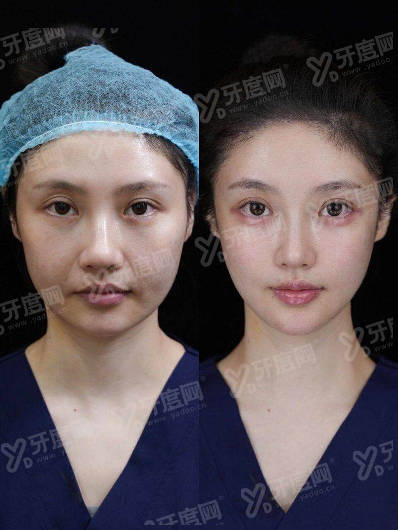 二、韩国釜山 evers 西面店有哪些让人安心的服务特色与正版保护？yanke.yadoo.cn
