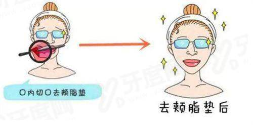 一、如何快速获取韩国釜山本思皮肤科面诊预约攻略并顺利到院？yanke.yadoo.cn