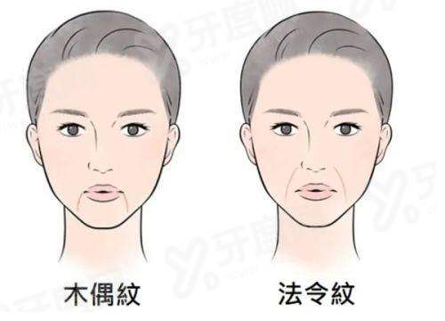 三、在韩国弘大 KLEAM 皮肤科做项目真实成效与口碑如何?yanke.yadoo.cn