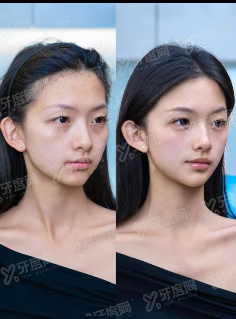 二、韩国釜山德佛斯特皮肤科有哪些特色诊疗项目与技术优势?yanke.yadoo.cn