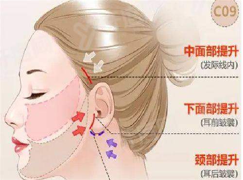 三、如何通过首尔 Eonni 轻松获取济州 NowMedi 医院的价格与实例?yanke.yadoo.cn