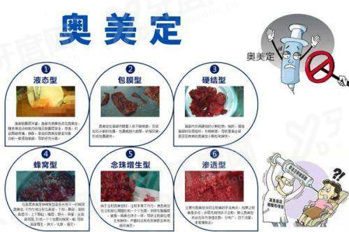 三、真实顾客如何评价韩国弘大 Kleam 皮肤科的服务体验?yanke.yadoo.cn