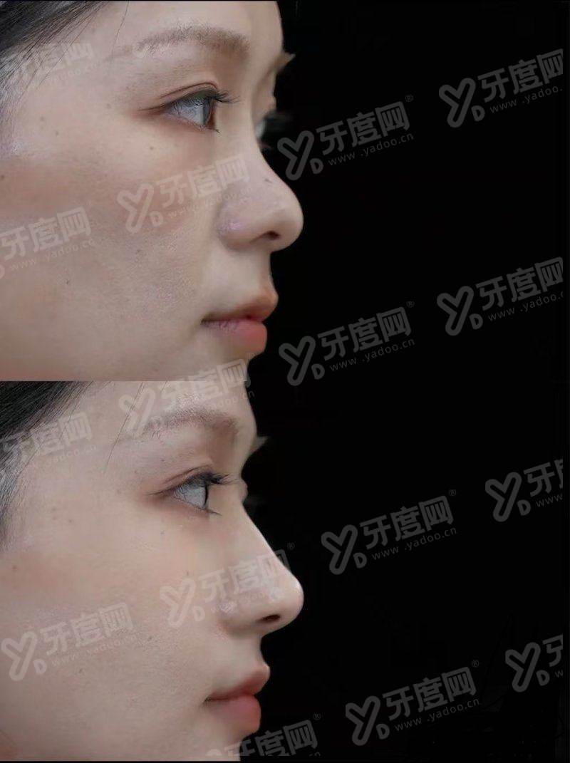 二、釜山本思皮肤科有哪些特色项目与价格参考?yanke.yadoo.cn