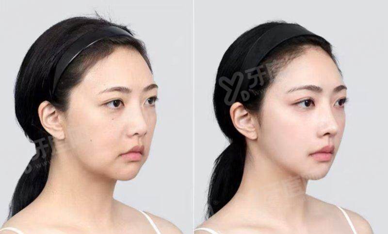 二、韩国弘大 Kleam 皮肤科有哪些特色技术与价格参考?yanke.yadoo.cn