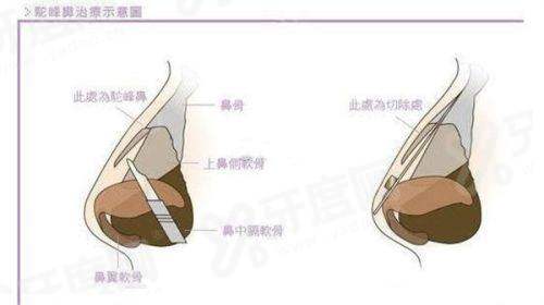 一、韩国 GTHERA 皮肤科在线预约教程三步走轻松搞定跨国面诊yanke.yadoo.cn
