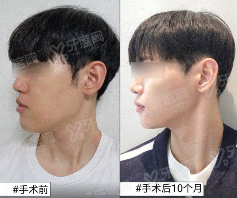 三、在济州 NowMedi 做医美大概需要多少预算?yanke.yadoo.cn