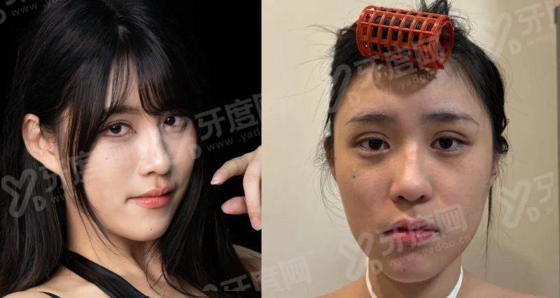 二、韩国釜山 evers 西面店有哪些独特的技术优势与医生团队?yanke.yadoo.cn