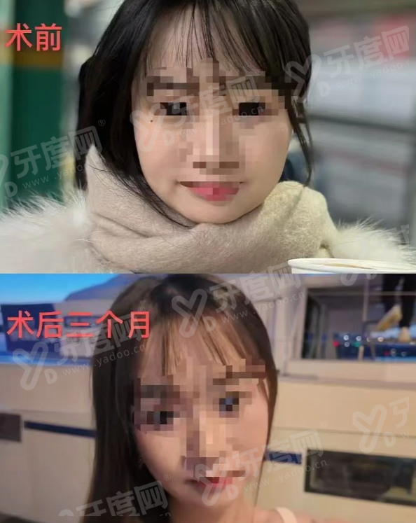 韩国明洞奥缇娜医院中文预约攻略：通过首尔Eonni小程序查价格，预约院长面诊