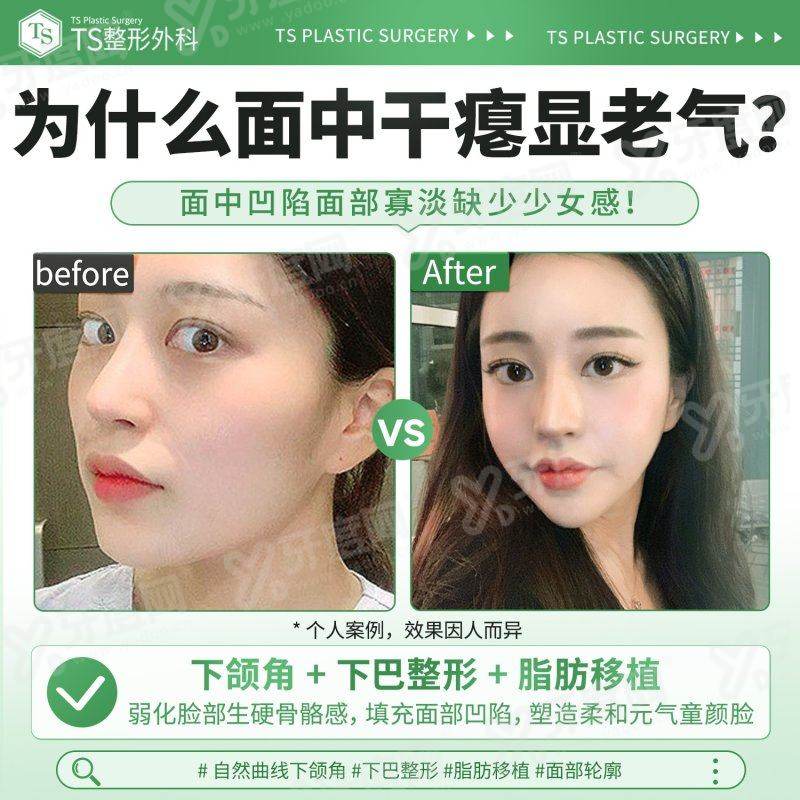 二、济州 NowMedi 医院有哪些独特的地域与技术优势?yanke.yadoo.cn